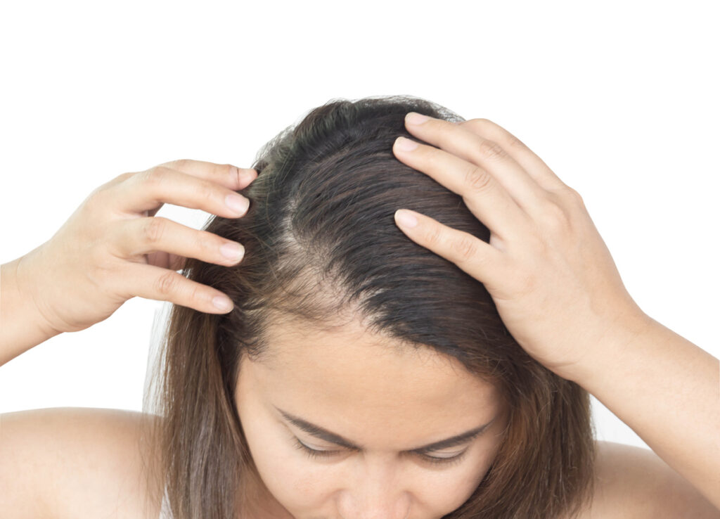 Woman looking at her scalp before PRP hair restoration for women in Albuquerque